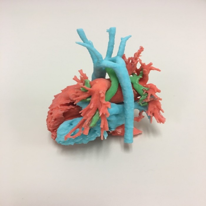 3D printed Color Heart Model of Infant