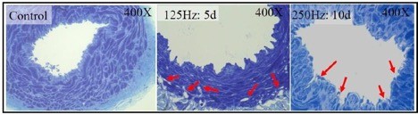 Vacuole formation (shown by red arrows) in the artery vibrated at 125 Hz for 5 day (125:5d) and 250 Hz for 10 days (250Hz: 10d). No vacuoles form in control artery (X400).