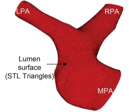 Lumen surface of the branched pulmonary arteries obtained from geometry reconstruction